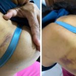 Diduga Aniaya ART, Oknum Dokter PNS di Bandar Lampung Dilaporkan ke Polisi